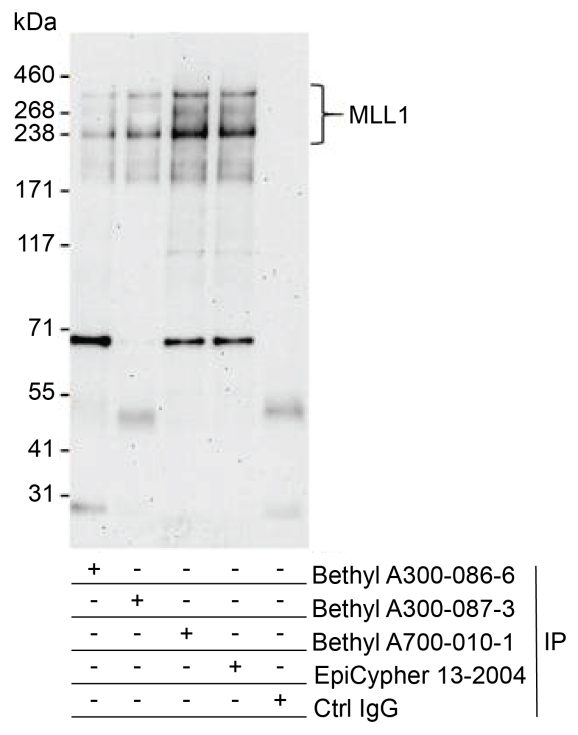 13-2004-immunoprecipitation