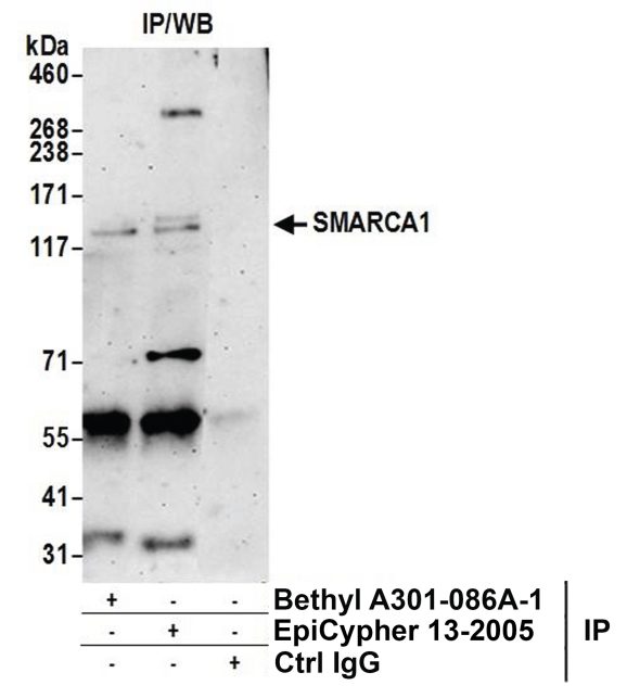 13-2005-immunoprecipitation-data