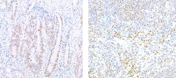 13-2014-immunohistochemistry