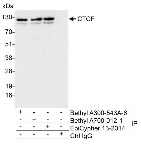 13-2014-immunoprecipitation-data