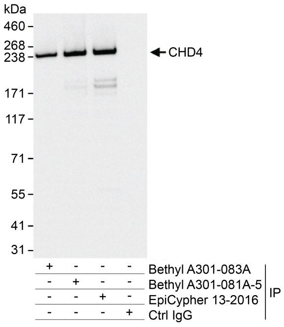 13-2016-immunoprecipitation