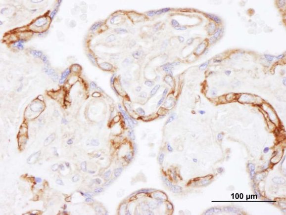 13-2018-immunohistochemistry