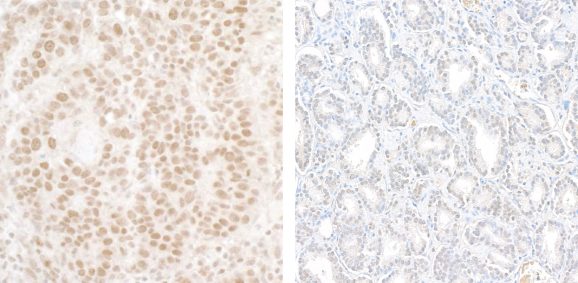 13-2021-immunohistochemistry-data