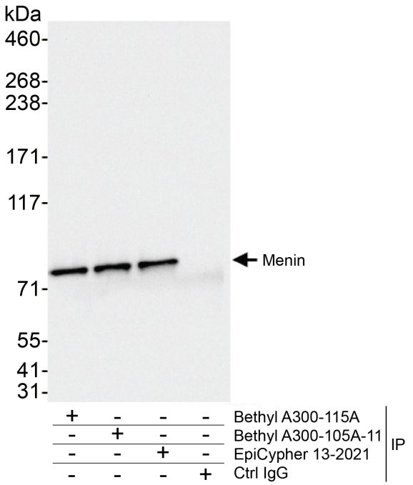 13-2021-immunoprecipitation-data