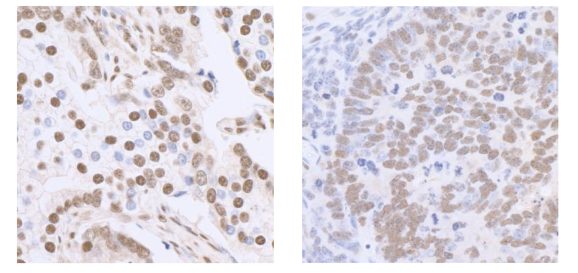 13-2024-immunohistochemistry-data