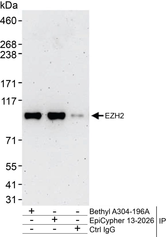 13-2026-immunoprecipitation-data
