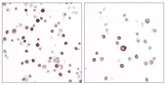13-2031_immunocytochemistry
