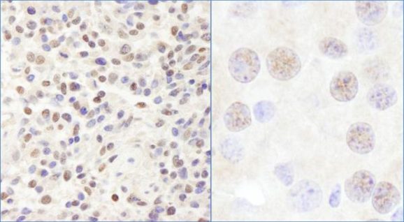 13_2009_CHD3_IHC