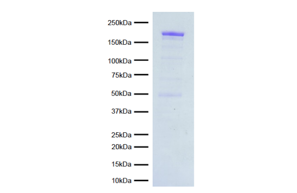 15-1014-protein-gel