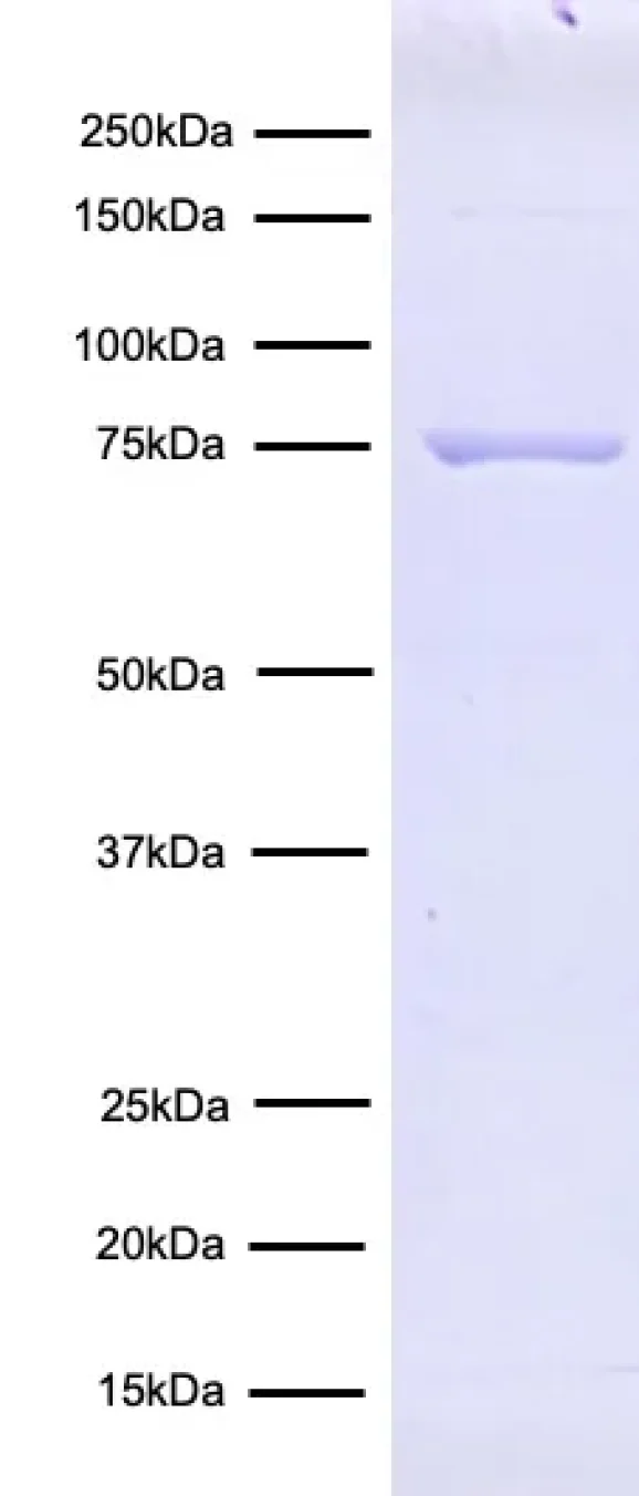 15-1025-protein-gel-data